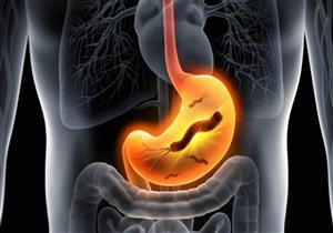 تعاني من جرثومة المعدة؟.. 5 مشروبات قد تساعد على العلاج