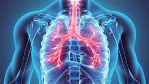  8 أشياء يمكنك تجريبها لإزالة أعراض السموم من رئتيك بشكل طبيعي