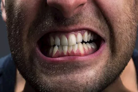 عادة ليلية خفية قد تُلحق أضرارًا دائمة بالأسنان.. احذر الأسباب