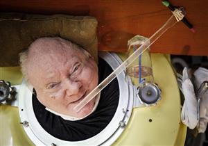 شلل الأطفال يجبر عجوزًا على الحياة برئة حديدية