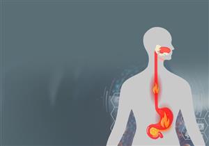 تعرف على خطورة ارتجاع العصارة الهضمية