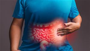    لمرضي القولون.. 8 نصائح ضرورية في أول أيام العيد