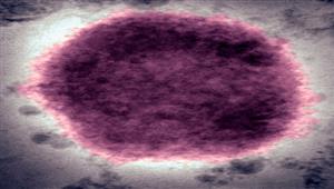  7 أعراض تكشف جدري القرود.. وكيفية انتقاله للإنسان 