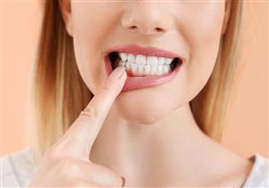 انحسار اللثة - إليك الفئات الأكثر عُرضة للإصابة بها