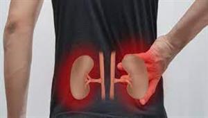 يدمر الكلى- تحذيرات من تناول إيبوبروفين مع أدوية الضغط