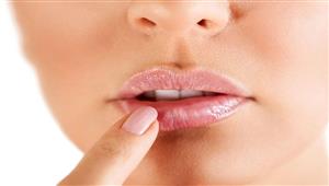  عوامل محفزة للإصابة بالهربس الفموي