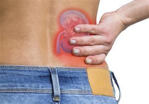 5 علامات تحذيرية تكشف عن وجود حصوات بالكلى