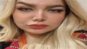  مناظرة النيابة لجثة المذيعة شيماء جمال: في حالة تعفن وتشوه في الوجه