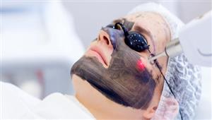  التقشير بالكربون.. مفتاح نقاء وشباب البشرة