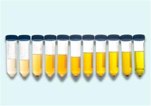 من لون البول- اكتشف مدى احتياجك لشرب الماء