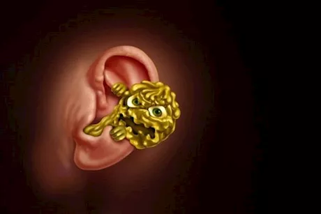  تراكم الشمع في الأذن.. كيف يمكنك التخلص منه دون آثار جانبية؟