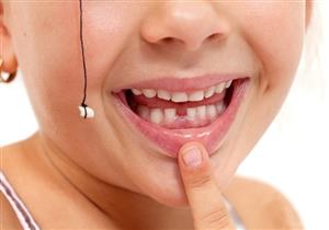 طبيب يكشف خطورة خلع الأسنان اللبنية للطفل مبكرًا