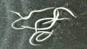 الديدان الدبوسية.. نصائح مهمة لحماية طفلك من الإصابة بها