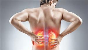 لتجنب الإصابة بحصوات الكلى.. افعل هذه الأشياء الـ 8 