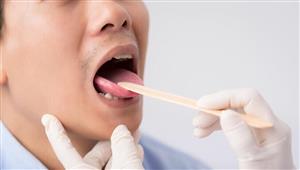  علامات في فمك تشير إلى ارتفاع مستوى السكر في الدم 