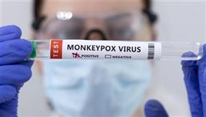 تسجيل أول حالة وفاة بجدري القرود في الولايات المتحدة