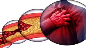 3 أطعمة تخفض مستويات الكوليسترول في الجسم بشكل سريع