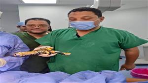 في جراحة عاجلة.. استخراج "جادون دراجة" من بطن طفل بالمنوفية