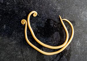 حسام موافي يحذر من دودة خطيرة تصيب الأمعاء: مصاصة دماء