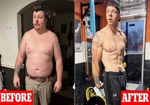 شاب يتناول 12 علبة صودا يوميًا- ماذا حدث له؟