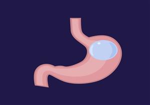 بعد عملية بالون المعدة- 4 عادات خاطئة تجنبها