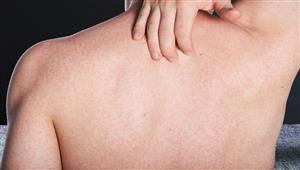 لا تتوقع.. هذا ما يشير إليه النتوءات تحت جلدك