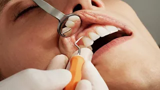 كيف يرسل الفم إنذارات مبكرة لـ السرطان؟