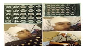 سائق يكسر جمجمة شابا بشاكوش في أوسيم