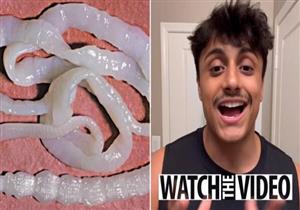 شاب يتناول الديدان لتحقيق مشاهدات على "تيك توك"- ماذا حدث له؟
