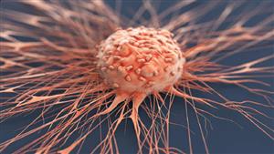 نوع شاي يحارب السرطان.. هذا ما يحدث للجسم عند تناوله 