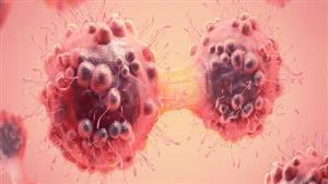 علامة تظهر في الجسم تكشف إصابتك بسرطان قاتل 