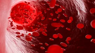 انتبه.. 5 أطعمة ومشروبات تمنع امتصاص الحديد وتسبب الأنيميا