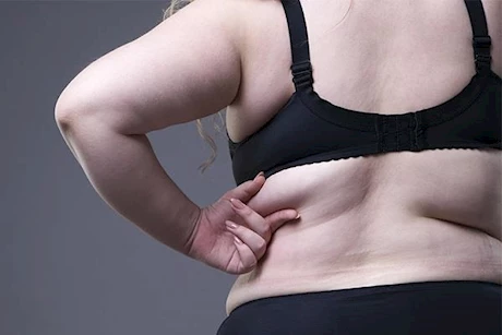 ودّع دهون الظهر وابدأ في نحت عضلاتك بخطوات بسيطة