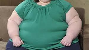 بعملية جراحية.. امرأة تفقد 115 كيلو من وزنها
