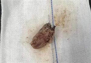 وفاة طفل ببنها بسبب حبة فراولة- ماذا حدث له؟