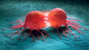 احذر.. 3 أطعمة مصنعة وشائعة تزيد من خطر إصابتك بـ السرطان