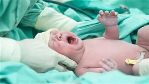 لن تصدق.. طفل يولد بجنين داخل بطنه - كيف حدث ذلك 