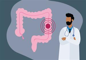 من برازك- كيف تكتشف إصابتك بسرطان القولون في المنزل؟