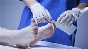  هشموا رأسه.. التحقيق في مقتل شخص بضربات 3 من جيرانه بحلوان