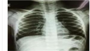 قريبًا.. مستشار وزير الصحة: إطلاق أول منصة تحتفظ بأشعة المرضى في مصر 