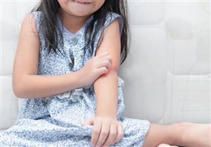 طفلك يعاني من الحكة المستمرة؟- إليك طرق علاجها