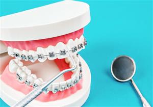 إهمال تنظيف أطقم الأسنان قد يهدد رئتيك بمرض خطير
