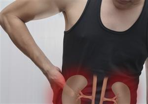 تهدد الكلى- حسام موافي يحذر من هذه العادة في رمضان