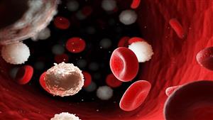 علامة غير متوقعة ظهرت على امرأة كشفت إصابتها بنوع سرطان خطير 