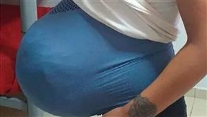 بطنها منفوخة بـ"المخدرات".. سيدة ادعت أنها حامل لتهريب المخدرات