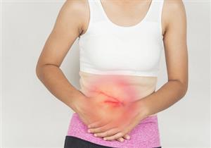 حسام موافي يحدد الأطعمة الممنوعة بعد استئصال المرارة