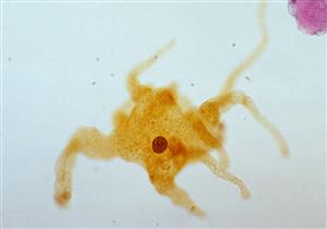 حسام موافي يحذر: انتفاخ البطن قد يكون علامة على ميكروب خطير