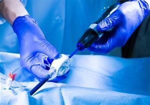 عملية القسطرة القلبية- طبيب يؤكد: هؤلاء أكثر حاجة إليها "فيديو"