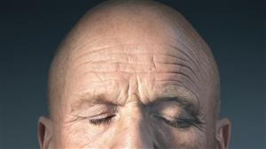  أكبر قاتل في العالم يظهر على الجبين.. وتستطيع اكتشافه بهذه الطريقة؟