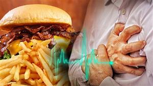 طبيب يحذر من تناول هذه الأطعمة: ضارة و"تقتل" القلب